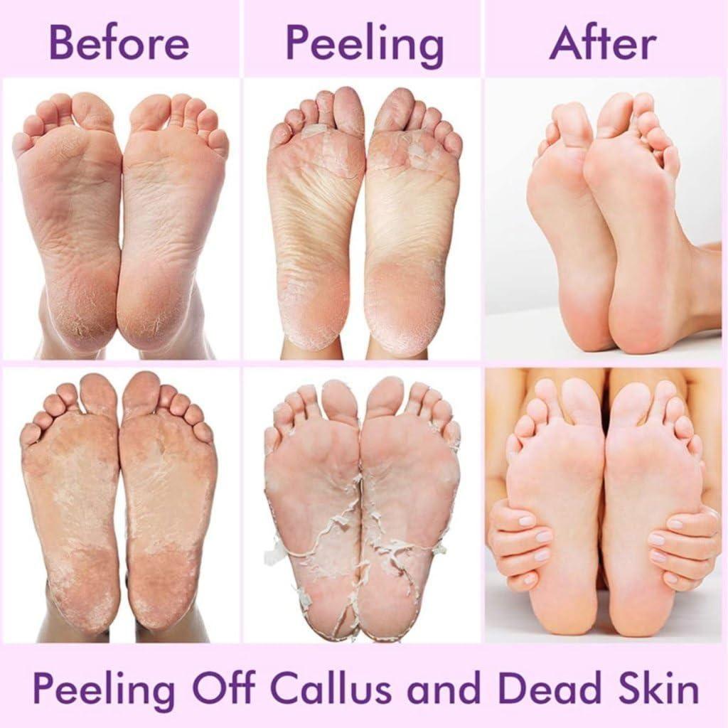 SeoulSkin Glycolic Acid Foot Peeling Mask